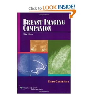 Click here to buy Breast Imaging Companion (Imaging Companion Series) by Gilda Cardenosa.