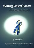 Beating Bowel Cancer