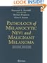 Pathology of Melanocytic Nevi and Malignant Melanoma