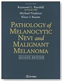 Pathology of Melanocytic Nevi and Malignant Melanoma