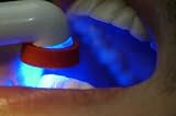 At Dentist - 24