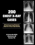200, chest x-ray cases