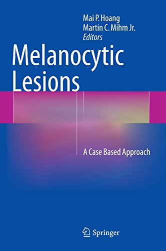 melanocytic lesions a case based approach