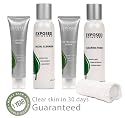 Exposed Acne Treatment - Basic Kit