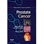 Prostate Cancer: Dana-Farber Cancer Institute Handbook (Dana-Farber Cancer Institute Handbooks)