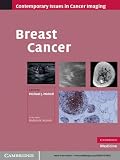 Breast Cancer
