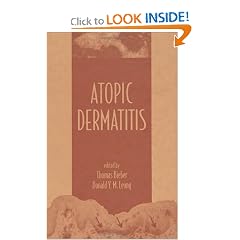 Atopic Dermatitis by Thomas Bieber and Donald Y. M. Leung