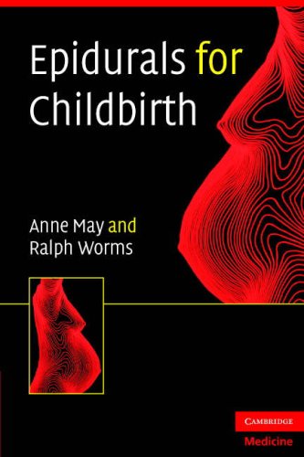 Epidurals