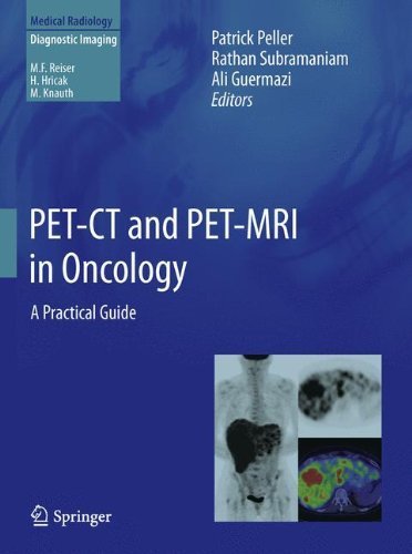 PET-CT and PET-MRI in Oncology: A Practical Guide (Medical Radiology) (2012-11-10)