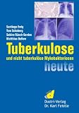 Tuberkulose und nicht tuberkulöse Mykobakteriosen heute