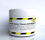 NEW Ultraclear EXTREME Acne Cream. If have tried everything, spent a FORTUNE on products and still have ACNE, SPOTS,BLACKHEADS - then you know Ultraclear EXTREME Acne Cream is 99% sure to help you out!