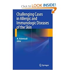 Challenging Cases in Allergic and Immunologic Diseases of the Skin by Massoud Mahmoudi