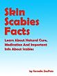 Skin Scabies Facts Learn About Natural Cure Medication