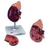 3B Scientific K12 2 Part Kidney with Adrenal Gland Model, 7.9