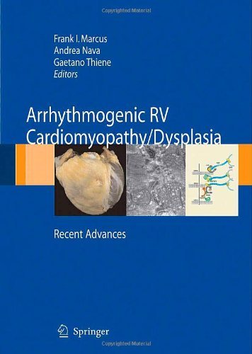 Arrhythmogenic RV Cardiomyopathy/Dysplasia: Recent Advances On Sale