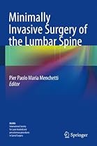 Minimally Invasive Surgery of the Lumbar Spine