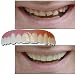 Imako Cosmetic Teeth (Color: Natural)