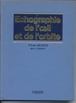 Echographie de l'oeil et de l'orbite
