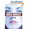 Birth marked T1