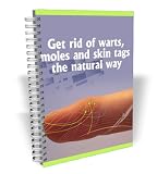 Get Rid of Warts, Moles and Skin Tags Naturaly Get Rid of Warts, Moles and Skin Tags Naturaly