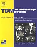 TDM de l abdomen aigu de l adulte
