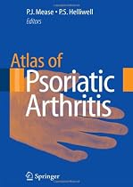 Atlas of Psoriatic Arthritis