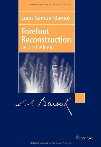 Forefoot Reconstruction