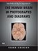 The Human Brain in Photographs and Diagrams with CD-ROM