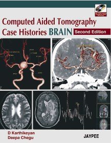 Computed-Tomography