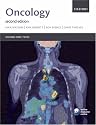 Oncology (Oxford Core Texts)