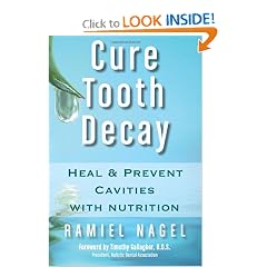 Click here to buy Cure Tooth Decay: Heal and Prevent Cavities with Nutrition, 2nd Edition by Ramiel Nagel and Timothy Gallagher.