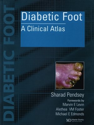 Diabetic-Foot