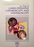 An atlas of laser operative laparoscopy and hysteroscopy
