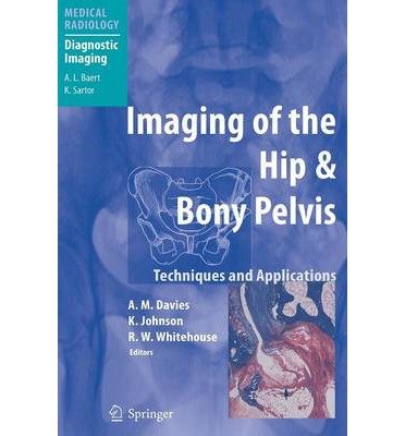 [ Imaging of the Hip & Bony Pelvis: Techniques and Applications (2006) BY Davies, A. M. ( Author ) ] { Hardcover } 2005