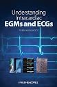 Understanding Intracardiac EGMs and ECGs