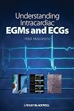 Understanding Intracardiac EGMs and ECGs