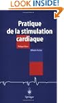 Pratique de la stimulation cardiaque