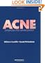 Acne: Diagnosis and Management