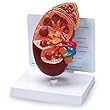Nasco Kidney Model - Model WA21315HR - Each