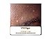 Vitiligo (Dermatology)
