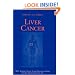 Liver Cancer (M.D. Anderson Solid Tumor Oncology Series)