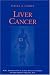 Liver Cancer (M.D. Anderson Solid Tumor Oncology Series)