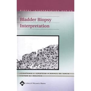 Click here to buy Bladder Biopsy Interpretation (Biopsy Interpretation Series) by Jonathan I. Epstein, Mahul B Amin, and Victor E Reuter.