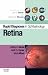  : Rapid Diagnosis in Ophthalmology Series: Retina (Rapid Diagnoses in Ophthalmology)