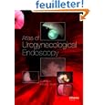 urethral sounds Atlas of urethral sounds Atlas of