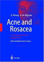 Acne and Rosacea