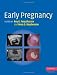 Early Pregnancy (Cambridge Medicine)