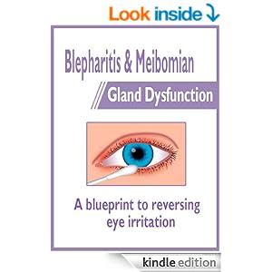 Blepharitis & Meibomian Gland Dysfunction: a blueprint to ...