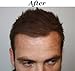 Mane America Hair Thickener Spray Combo (Dark Brown) by Mane America