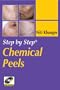 Step by Step Chemical Peels